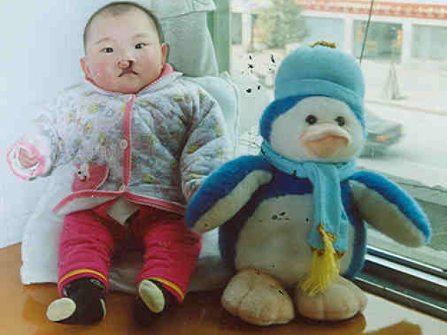 child with cleft lip sitting by stuffed animal