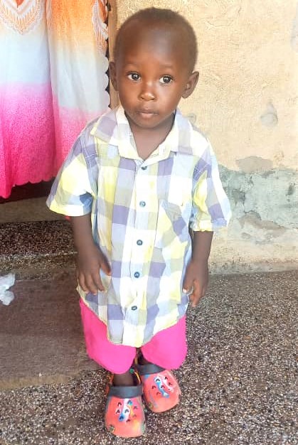 Young boy needing hernia surgery in Uganda