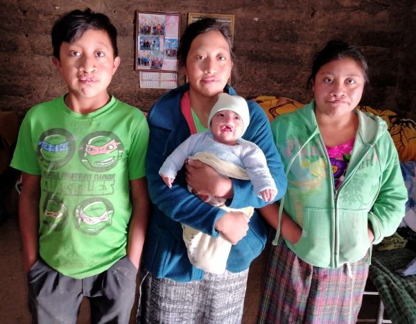 Family who all have cleft lip