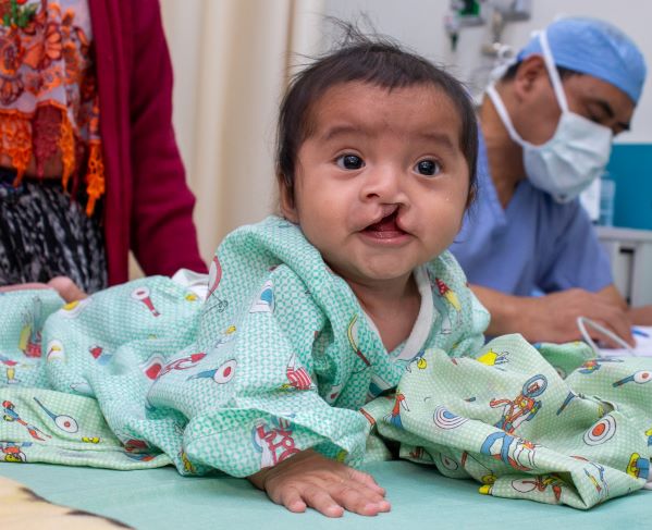 Guatemalan baby with cleft lip on tummy