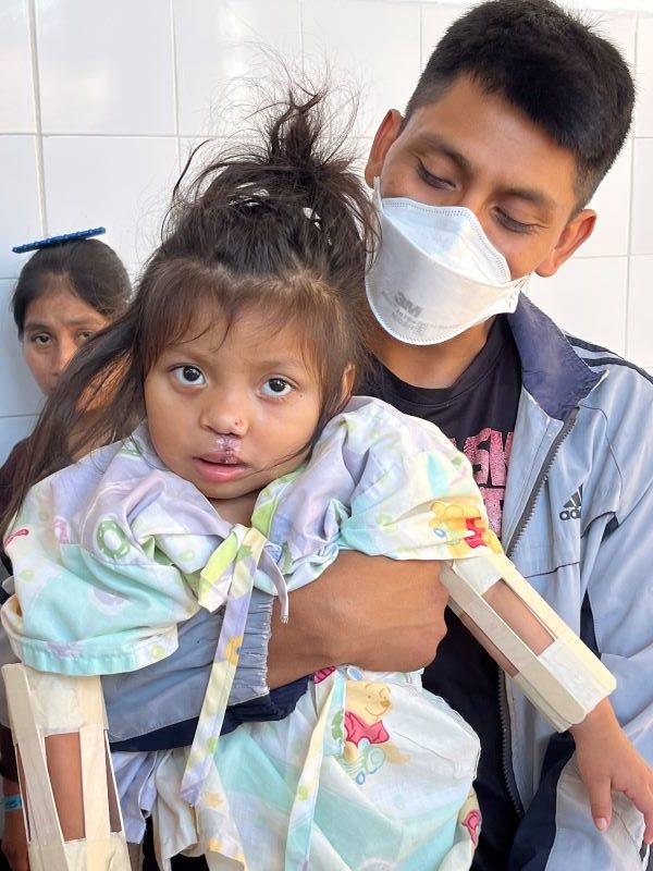 Girl wearing no-nos in dad's arms after cleft surgery