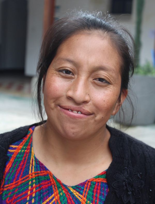 Guatemala mom with cleft lip