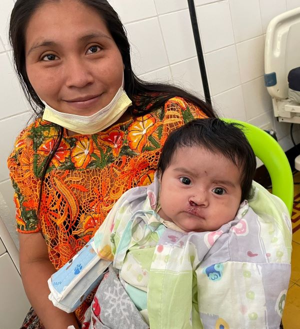 Guatemalan mother and baby after cleft repair surgery