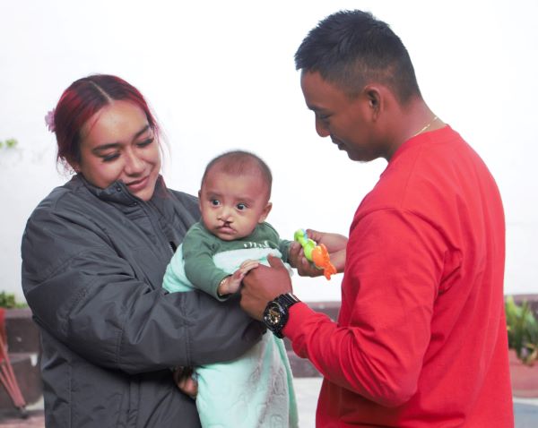 Parents with their son born with cleft lip