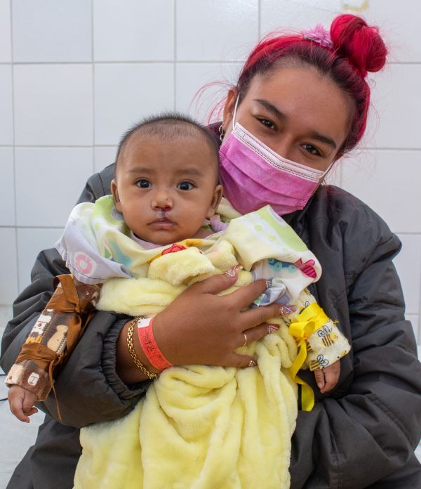 Mom holding her son after cleft lip repair surgery