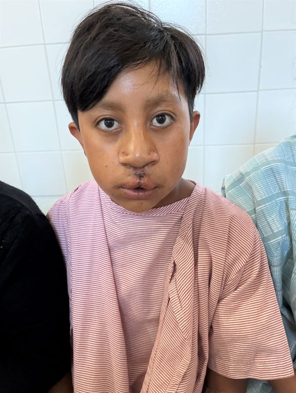 Teenage boy in hospital after cleft surgery
