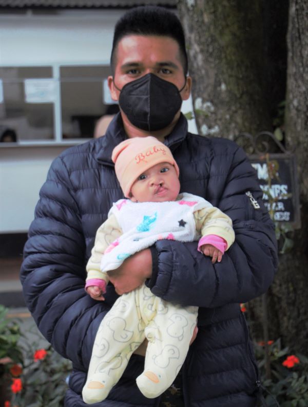 Father holds daughter with cleft lip in Guatemala