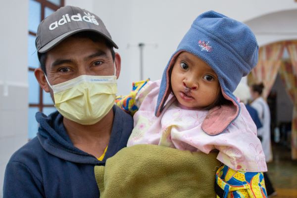 Father and daughter in Guatemala after cleft lip surgery