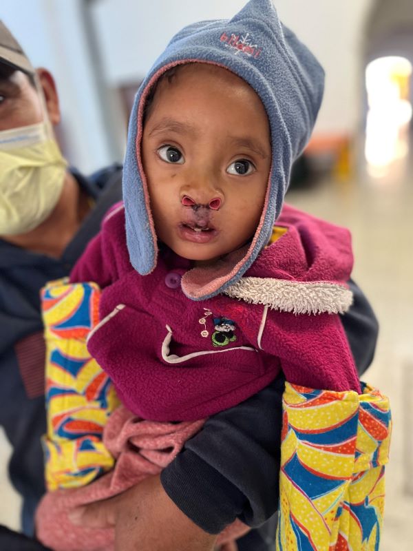 Girl in blue hat after cleft repair surgery