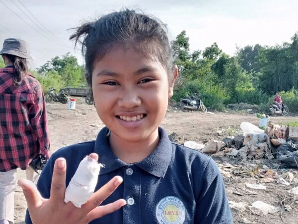Girl with a bandaged finger at landfill in Cambodia