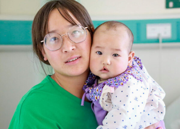 Baby with Cleft Lip and Palate being held by her mother