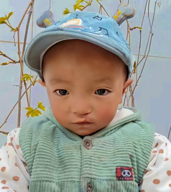 Boy born with Cleft Lip and Palate wearing a baseball cap