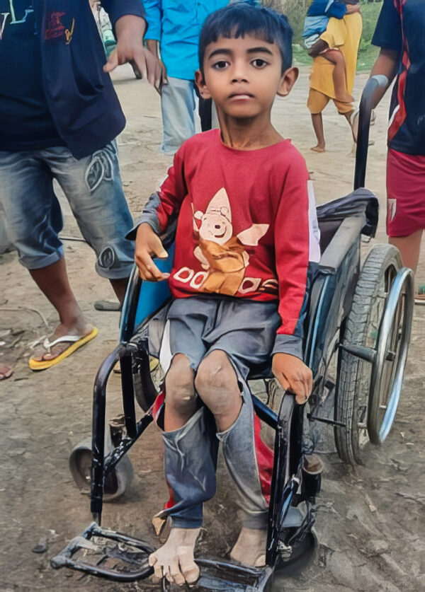 Little boy with holes in his pants sits in a wheelchair in Cambodia