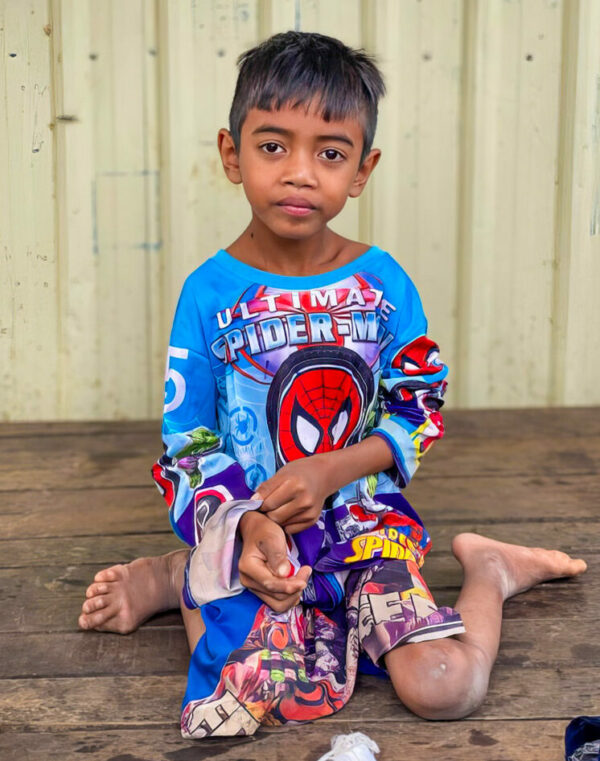 Boy with cerebral palsy sits on ground in Spiderman clothes