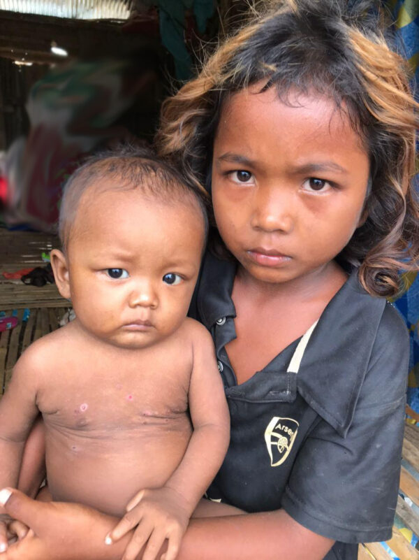 Older sister holds baby brother on her lap as both suffer from malnutrition 20 Years of Hope Rena and Her Siblings