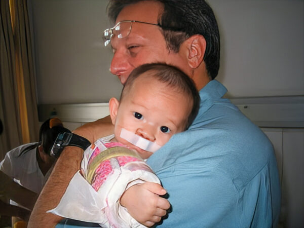 Compassionate doctor holds a baby following cleft lip repair