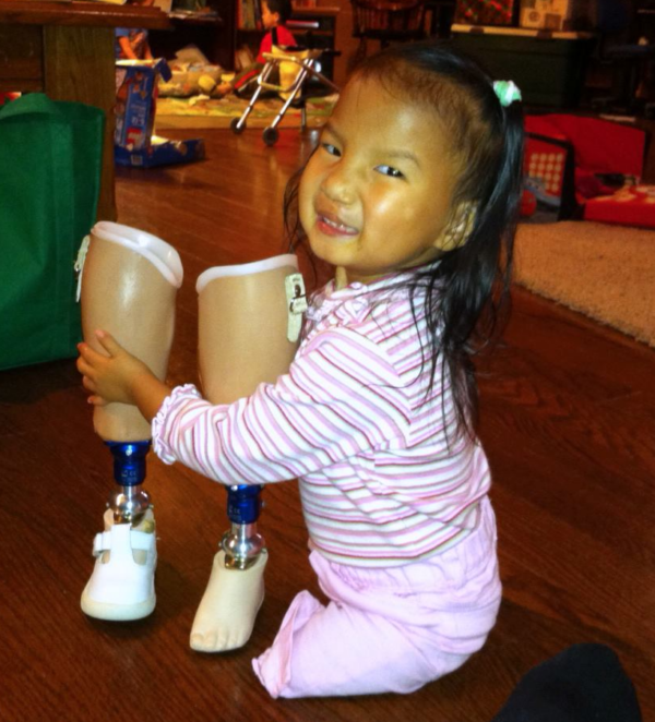 Little girl in pink hugging two prosthetic legs