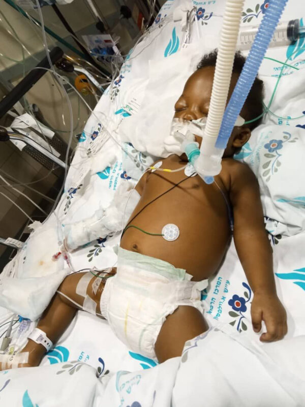 Baby on a ventilator following cardiac surgery