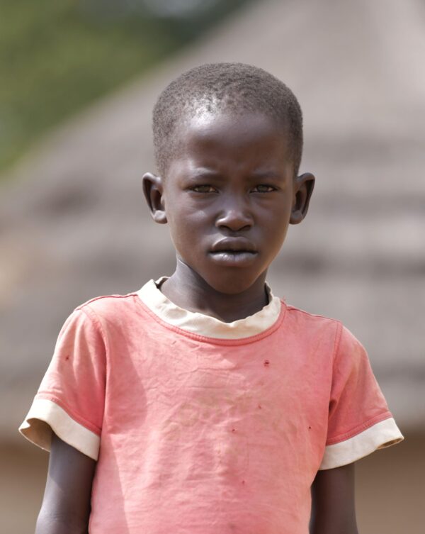Young Ugandan boy in a salmon t-shirt waiting for cardiac surgery