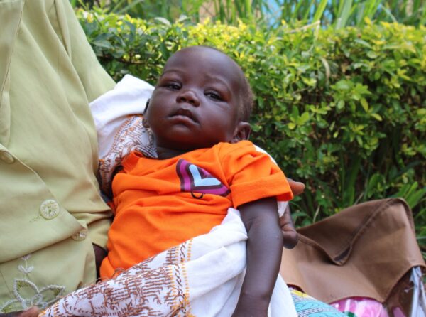 Sick Ugandan child in orange shirt at pediatric hernia mission