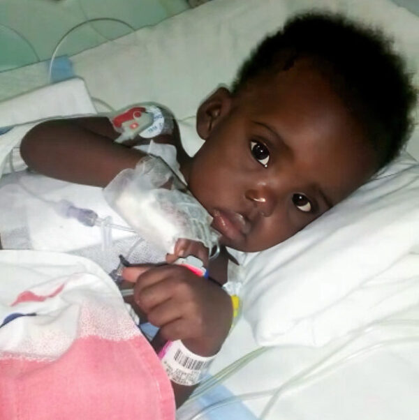 Ugandan toddler girl in hospital bed after cardiac surgery