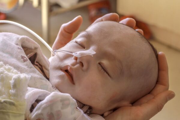 A fragile baby with oxygen whose head is being held in someone's hands