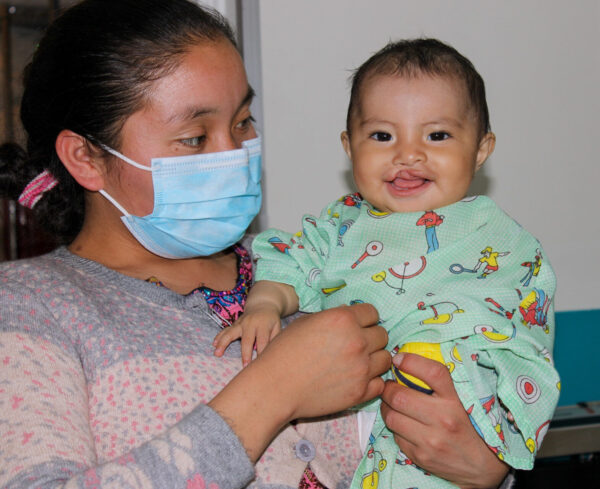 Mom holding her baby with cleft lip in Guatemala