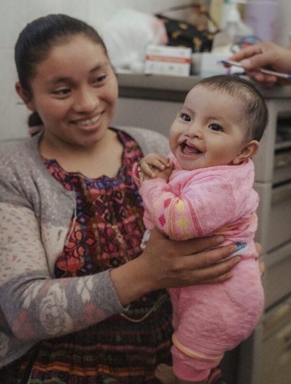 Mom holding baby with cleft lip in Guatemala