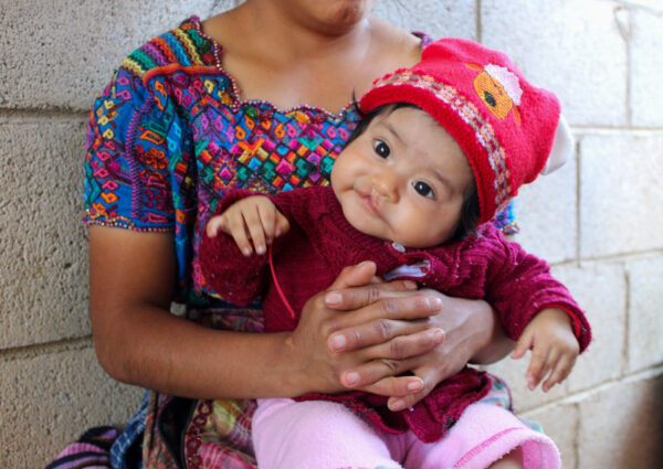Guatemalan baby with cleft lip sits on her mom's lap