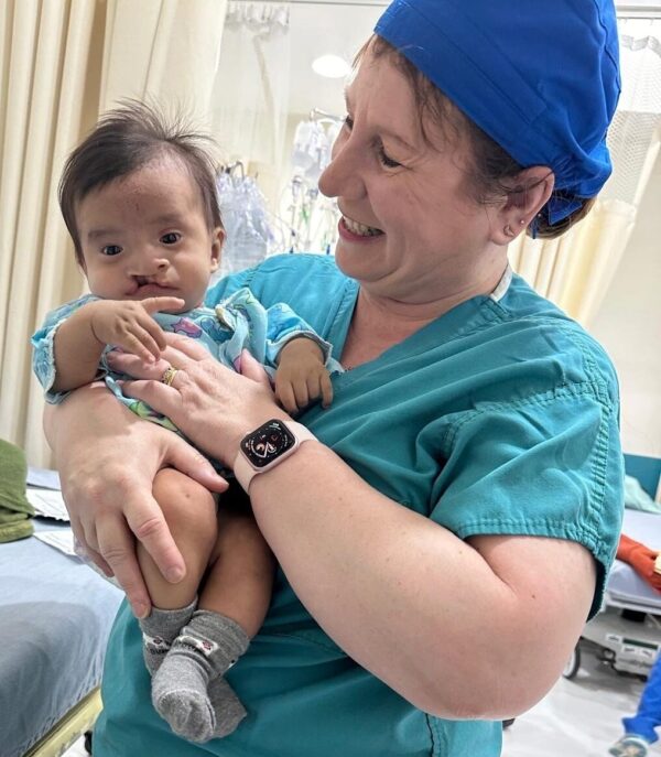 Nurse holds a baby waiting for cleft surgery