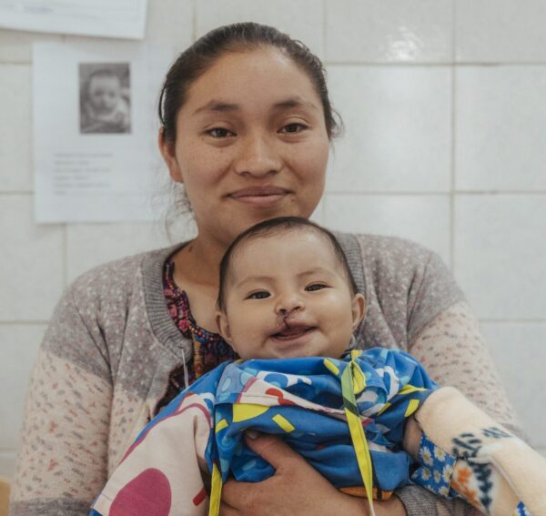 Mom and baby after cleft lip repair surgery