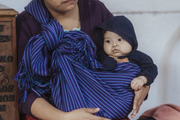 Baby in a blue striped sling waiting for cleft surgery