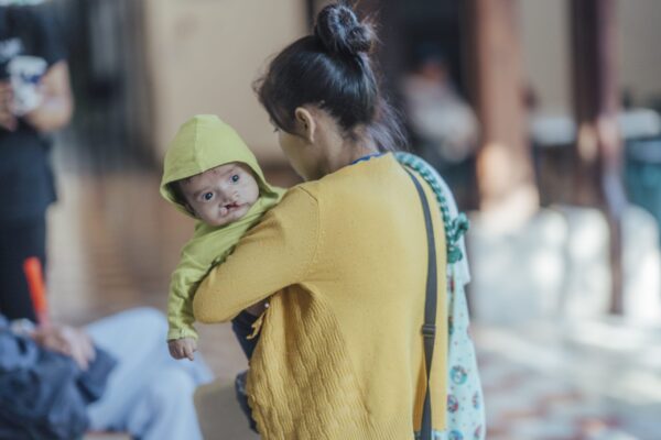Woman in yellow holds small baby with cleft lip