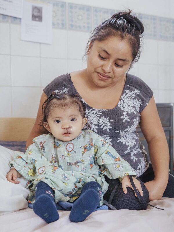 Our 2024 Guatemala Cleft Trip:  Day Five of Surgeries