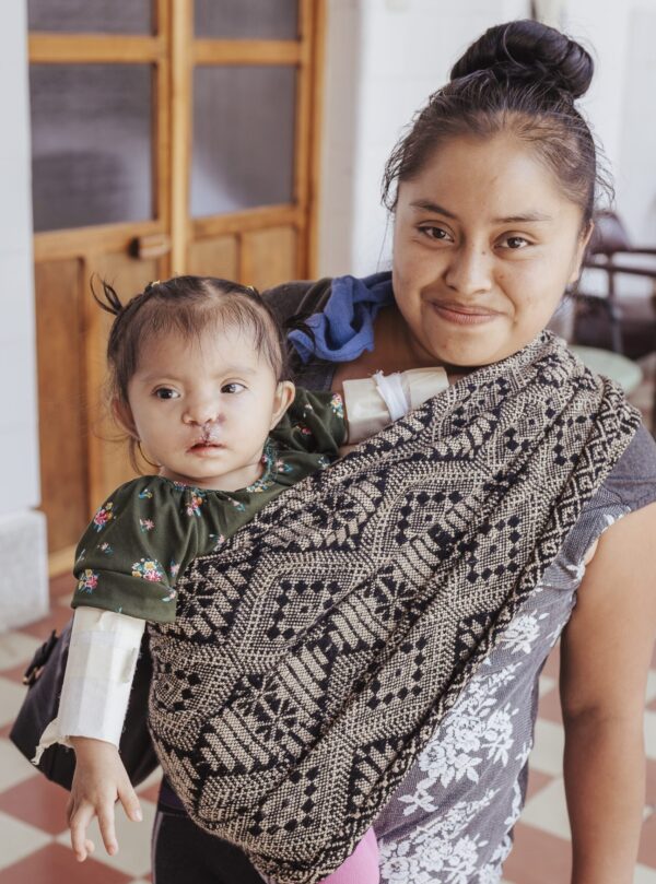 Mom carrying baby girl in a sling in Guatemala after cleft lip surgery