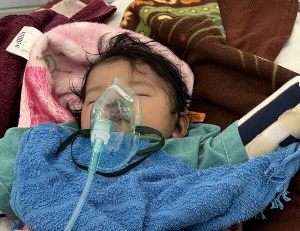 Baby with oxygen recovering from cleft surgery