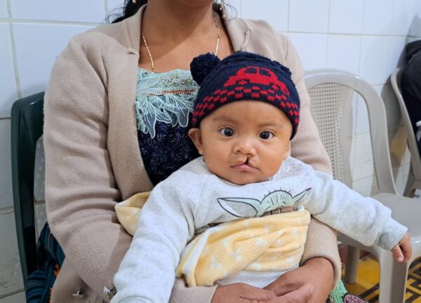 Little boy with cleft lip sits on mother's lap in hospital
