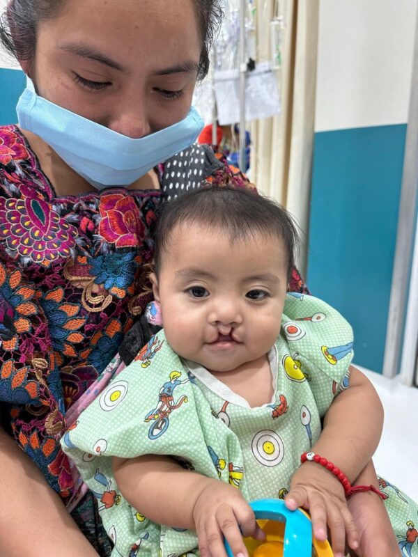 Baby with cleft lip and his mom wait in hospital for surgery