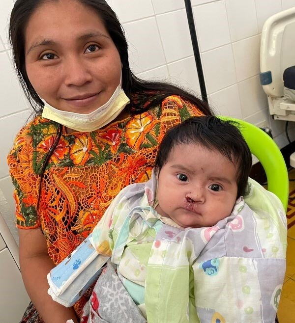 Smiling mom and baby after cleft lip surgery